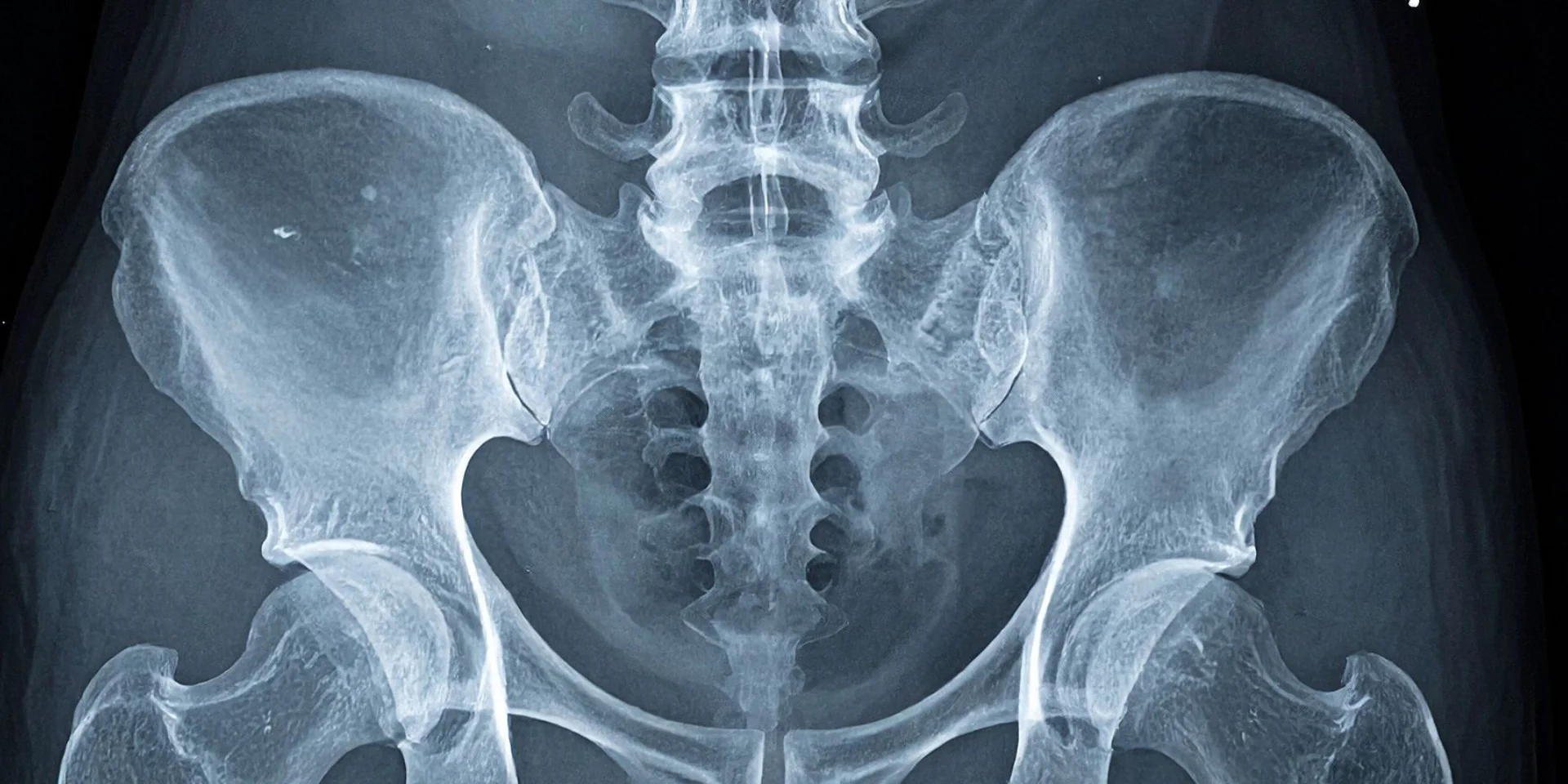 Minster Chiropractic Center lower back x-ray